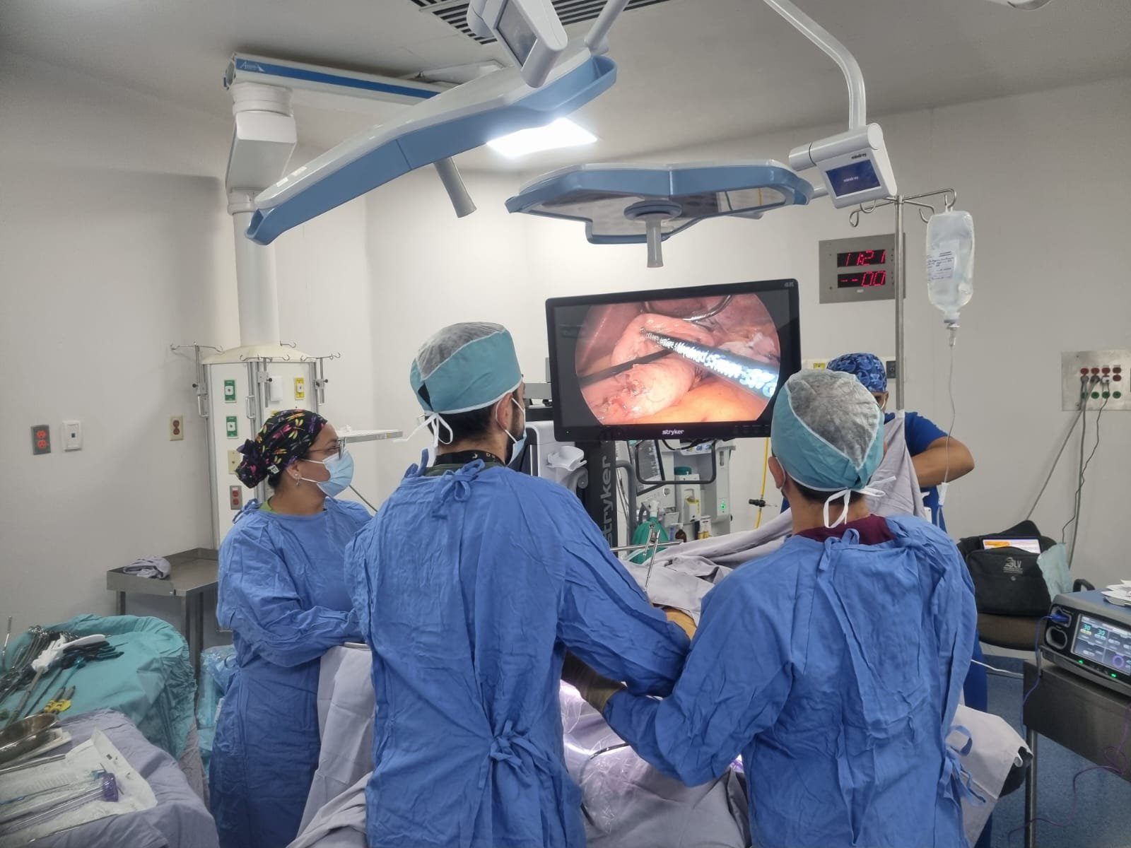 Equipo quirúrgico realizando una cirugía laparoscópica con monitor en el quirófano